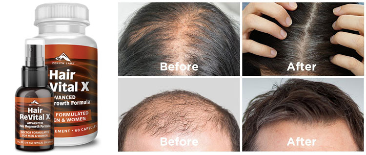Hair Revital X Review