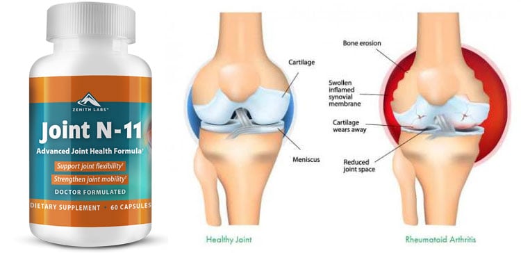 Joint N-11 Review