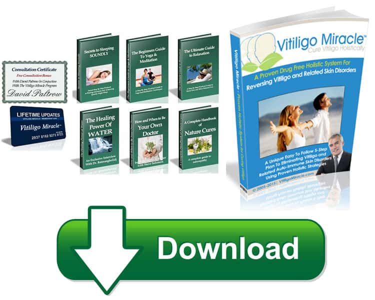 Vitiligo Miracle Download