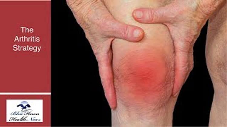 The Arthritis Strategy Review