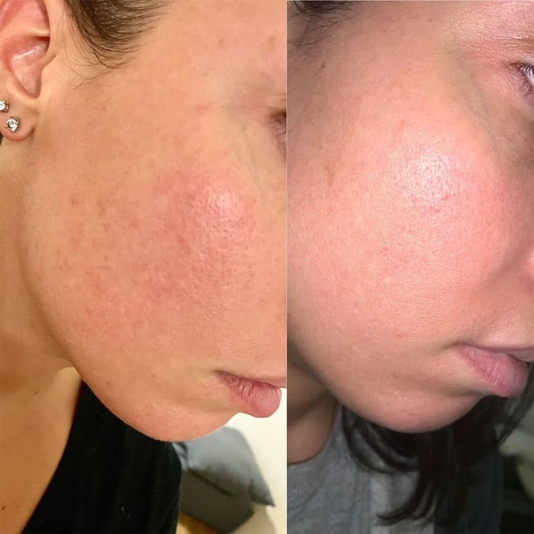 Improve-skin-and-your-face