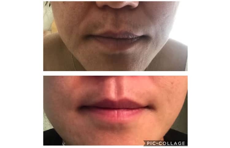 Work-on-dark-skin,-light-skin,-both-oily-and-dry-skin