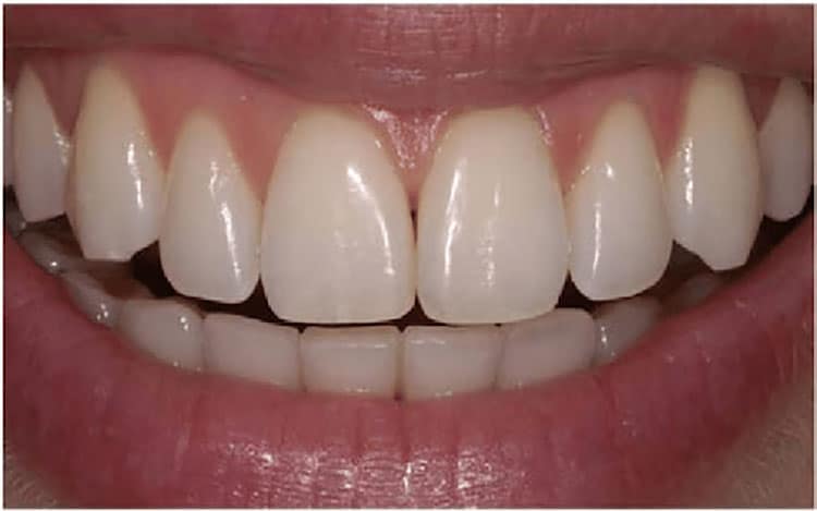 Effective dental health