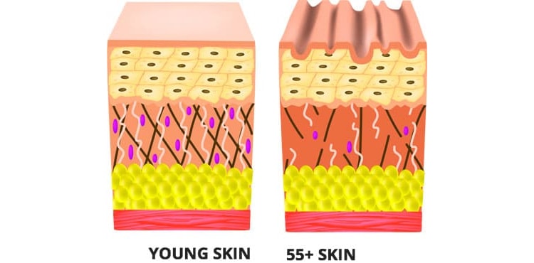 Lose up to 30% of your collagen by the time you hit 40