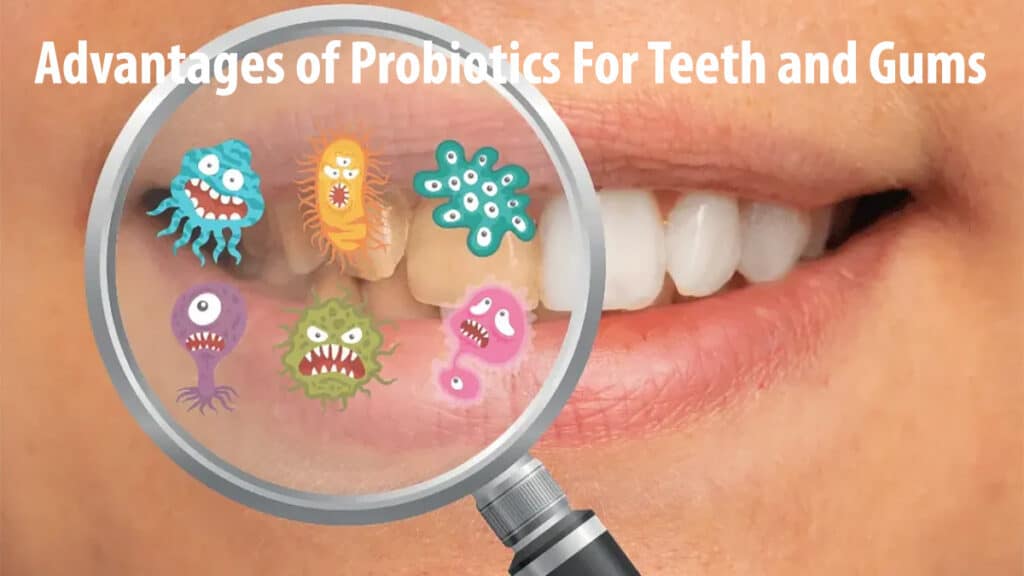 Advantages of Probiotics For Teeth and Gums